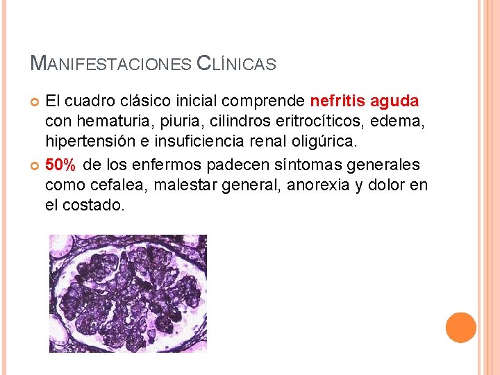 MANIFESTACIONES CLÍNICAS El cuadro clásico inicial comprende nefritis aguda con hematuria, piuria, cilindros eritrocíticos,