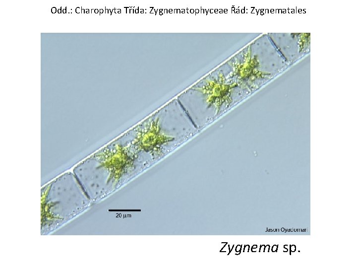 Odd. : Charophyta Třída: Zygnematophyceae Řád: Zygnematales Zygnema sp. 