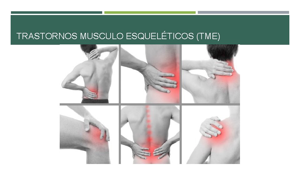 TRASTORNOS MUSCULO ESQUELÉTICOS (TME) TRASTORNOS MUSCULO ESQUELÉTICOS (TME)