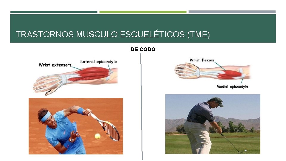 TRASTORNOS MUSCULO ESQUELÉTICOS (TME) DE CODO TRASTORNOS MUSCULO ESQUELÉTICOS (TME) DE CODO