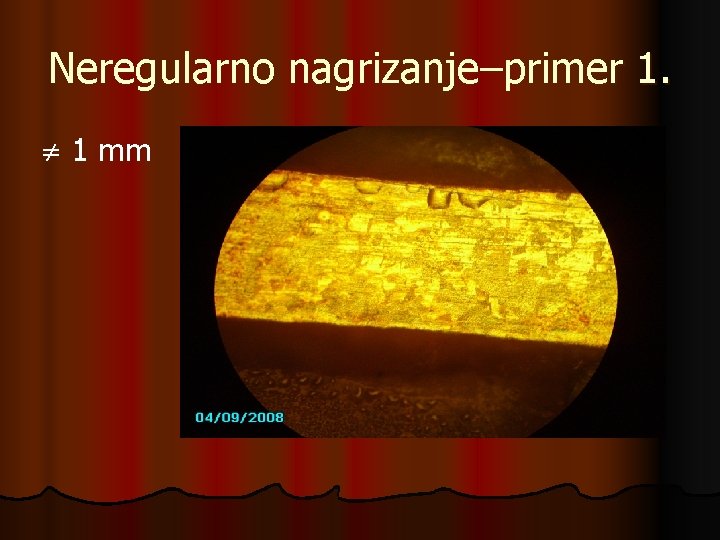 Neregularno nagrizanje–primer 1. 1 mm 