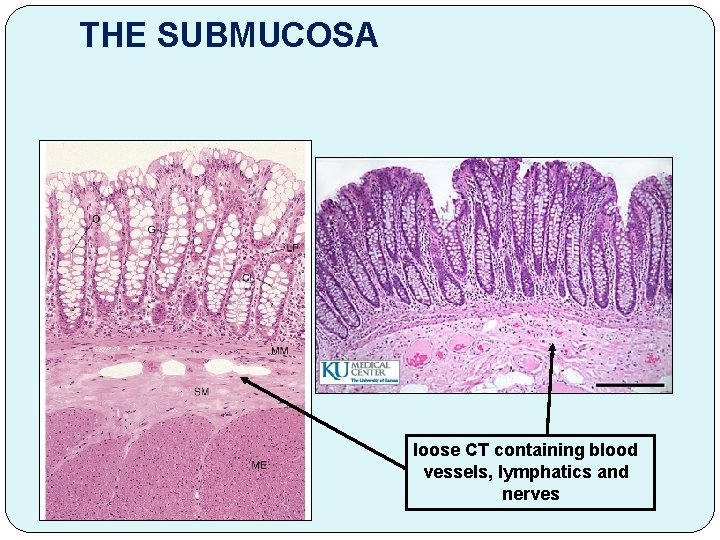 THE SUBMUCOSA loose CT containing blood vessels, lymphatics and nerves 