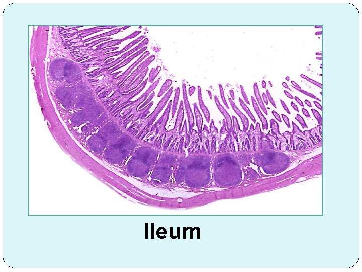 Ileum 