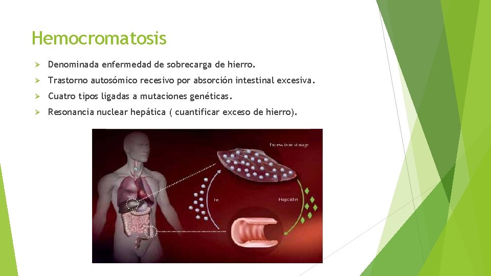 Hemocromatosis Denominada enfermedad de sobrecarga de hierro. Trastorno autosómico recesivo por absorción intestinal excesiva.