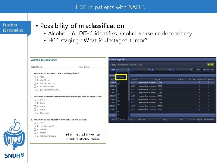 HCC in patients with NAFLD Further discussion • Possibility of misclassification • Alcohol :