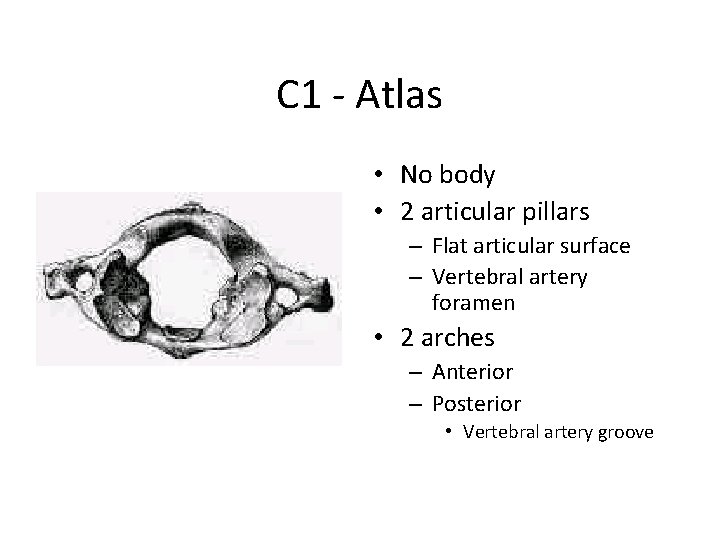 C 1 - Atlas • No body • 2 articular pillars – Flat articular