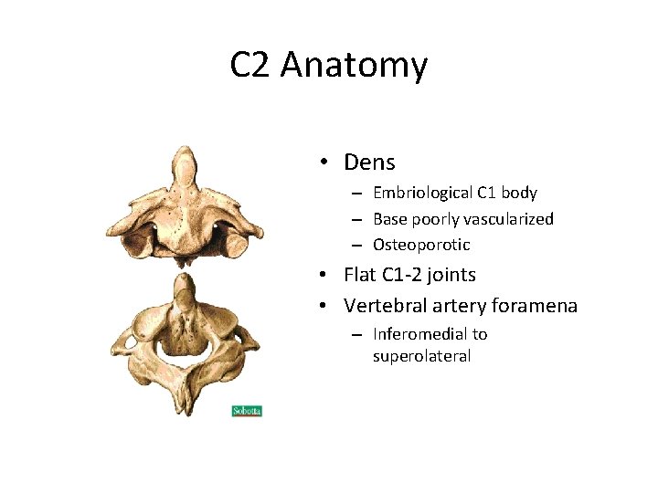 C 2 Anatomy • Dens – Embriological C 1 body – Base poorly vascularized