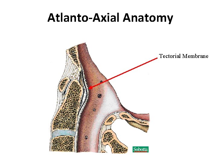 Atlanto-Axial Anatomy Tectorial Membrane 