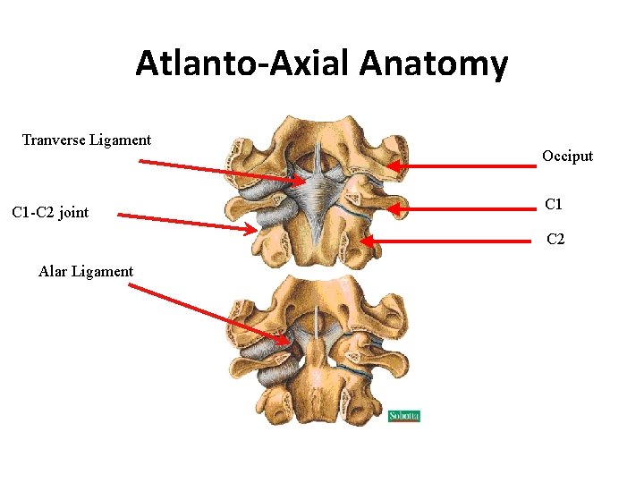 Atlanto-Axial Anatomy Tranverse Ligament C 1 -C 2 joint Occiput C 1 C 2