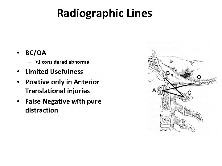 Radiographic Lines Powers’ Ratio • BC/OA – >1 considered abnormal • Limited Usefulness •