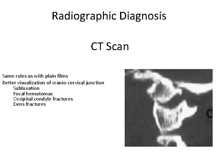 Radiographic Diagnosis CT Scan Same rules as with plain films Better visualization of cranio-cervical