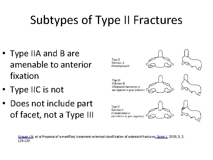 Subtypes of Type II Fractures • Type IIA and B are amenable to anterior