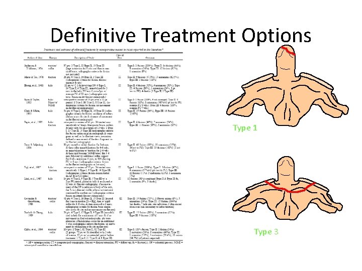 Definitive Treatment Options Type 1 C-Collar beware unrecognized CCD Evidence-based analysis of odontoid fracture