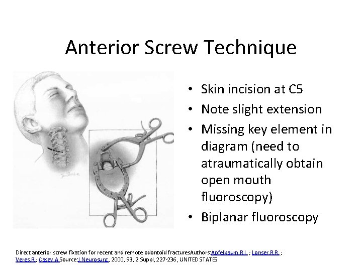 Anterior Screw Technique • Skin incision at C 5 • Note slight extension •