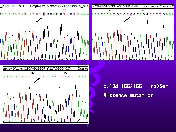 c. 138 TGG>TCG Trp>Ser Missence mutation 
