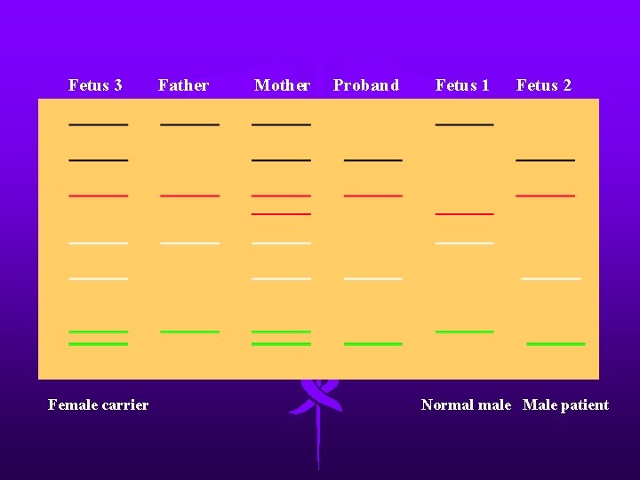 Fetus 3 Female carrier Father Mother Proband Fetus 1 Fetus 2 Normal male Male