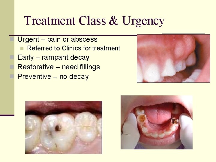 Treatment Class & Urgency n Urgent – pain or abscess n Referred to Clinics Treatment Class & Urgency n Urgent – pain or abscess n Referred to Clinics