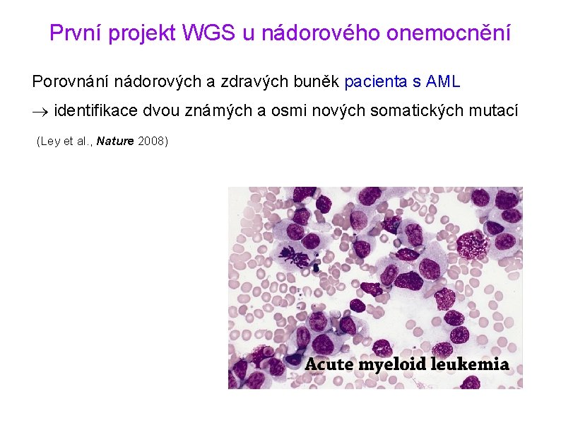 První projekt WGS u nádorového onemocnění Porovnání nádorových a zdravých buněk pacienta s AML