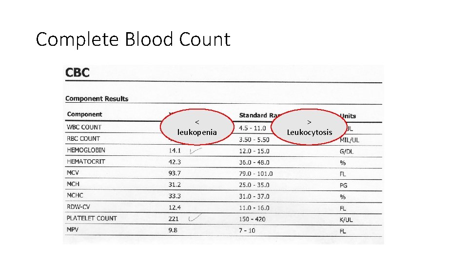 Complete Blood Count < leukopenia > Leukocytosis 