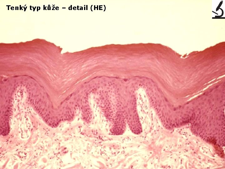 Tenký typ kůže – detail (HE) 