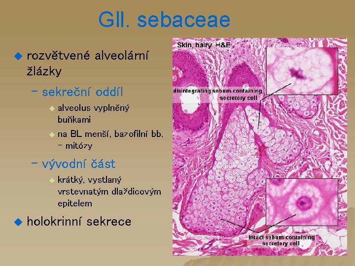 Gll. sebaceae u rozvětvené alveolární žlázky – sekreční oddíl u alveolus vyplněný buňkami u