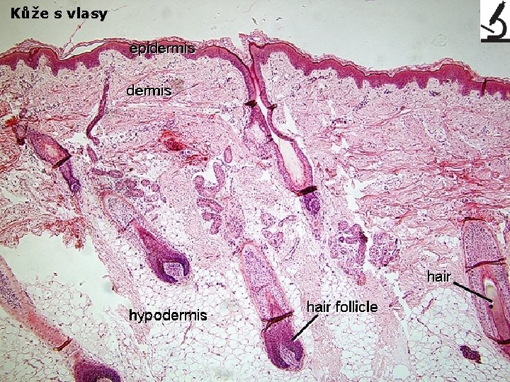 Kůže s vlasy 