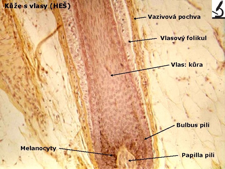 Kůže s vlasy (HEŠ) Vazivová pochva Vlasový folikul Vlas: kůra Bulbus pili Melanocyty Papilla