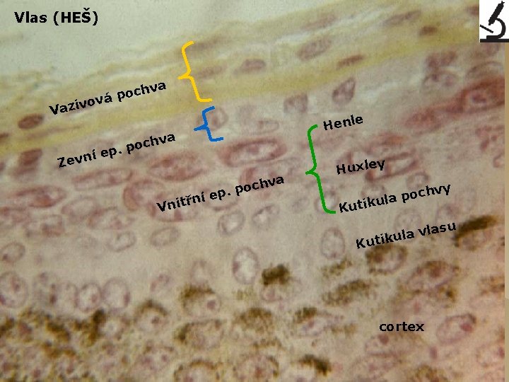 Vlas (HEŠ) va h c o vá p o v i Vaz e Henl