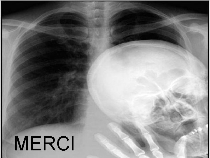 MEEEEEEERCI MERCI 