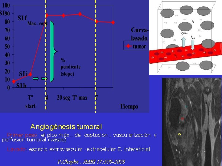 Angiogénesis tumoral Primer paso: el pico máx. . de captación , vascularización y perfusión