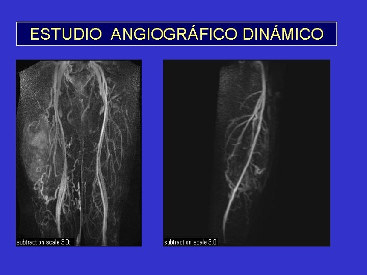 ESTUDIO ANGIOGRÁFICO DINÁMICO 