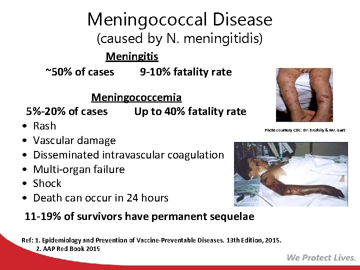 Meningococcal Disease (caused by N. meningitidis) Meningitis ~50% of cases 9 -10% fatality rate