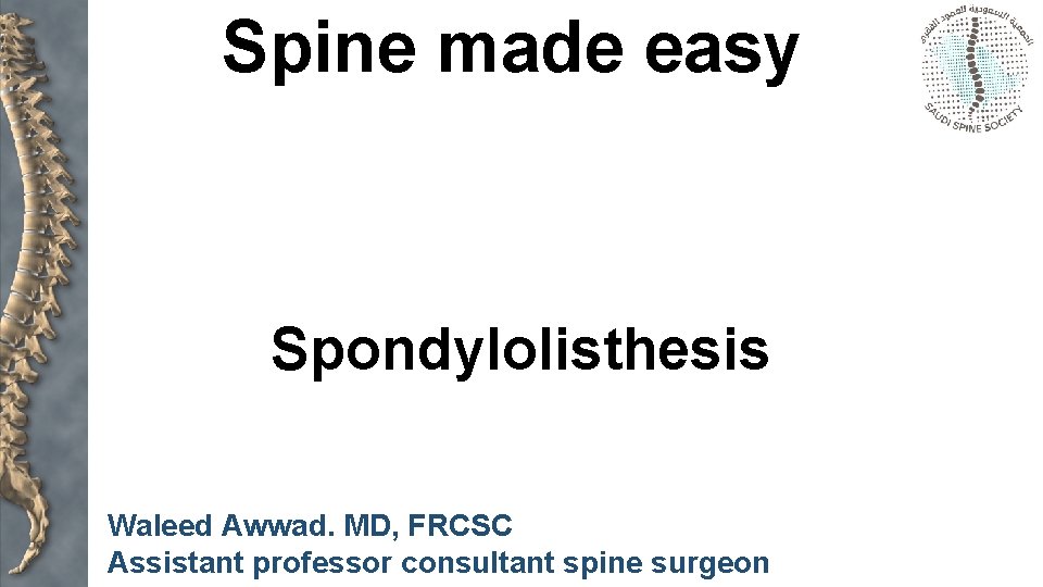Spine made easy Spondylolisthesis Waleed Awwad. MD, FRCSC Assistant professor consultant spine surgeon 
