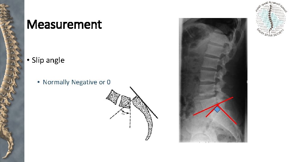 Measurement • Slip angle • Normally Negative or 0 