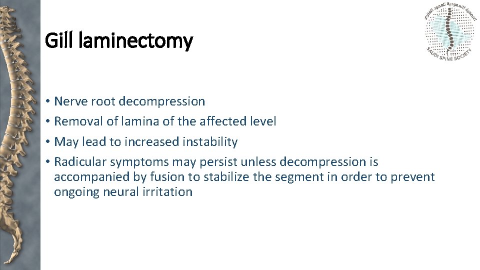 Gill laminectomy • Nerve root decompression • Removal of lamina of the affected level