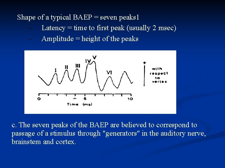 Shape of a typical BAEP = seven peaks 1 – Latency = time to