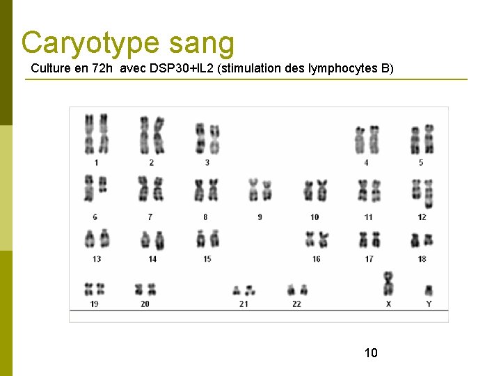 Caryotype sang Culture en 72 h avec DSP 30+IL 2 (stimulation des lymphocytes B)