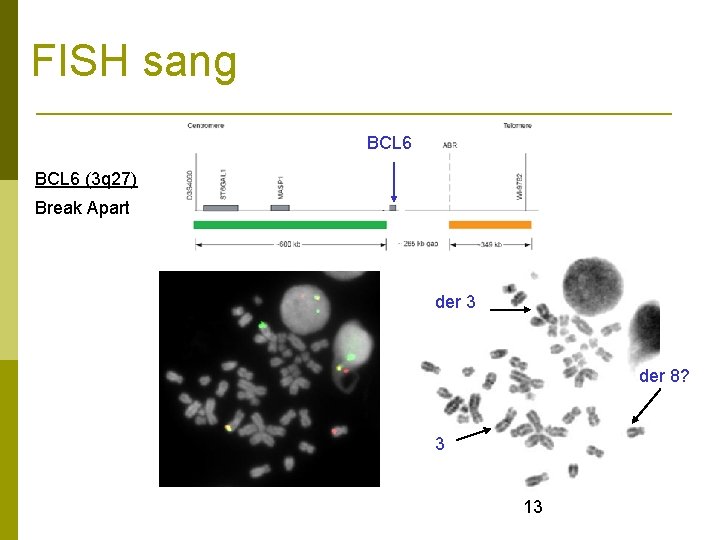 FISH sang BCL 6 (3 q 27) Break Apart der 3 der 8? 3