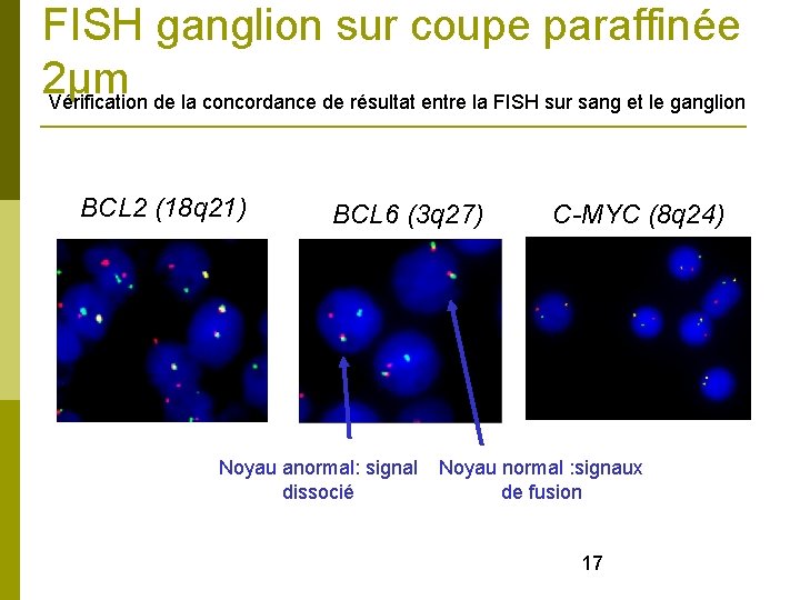FISH ganglion sur coupe paraffinée 2µm Vérification de la concordance de résultat entre la