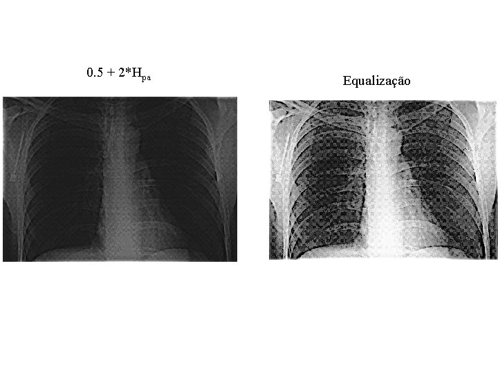 0. 5 + 2*Hpa Equalização 0. 5 + 2*Hpa Equalização
