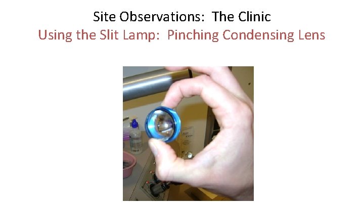 Site Observations: The Clinic Using the Slit Lamp: Pinching Condensing Lens 