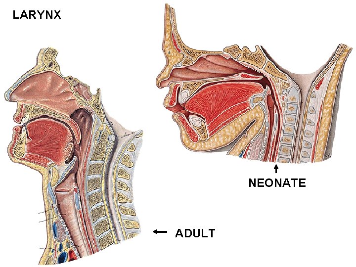 LARYNX NEONATE ADULT LARYNX NEONATE ADULT
