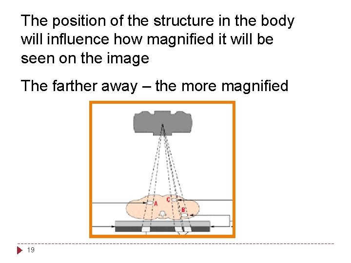 The position of the structure in the body will influence how magnified it will