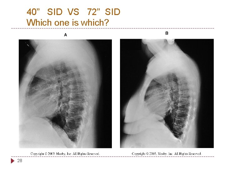 40” SID VS 72” SID Which one is which? 28 