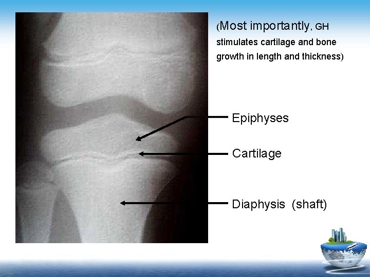 (Most importantly, GH stimulates cartilage and bone growth in length and thickness) Epiphyses Cartilage