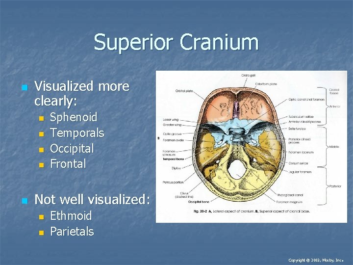 Superior Cranium n Visualized more clearly: n n n Sphenoid Temporals Occipital Frontal Not Superior Cranium n Visualized more clearly: n n n Sphenoid Temporals Occipital Frontal Not