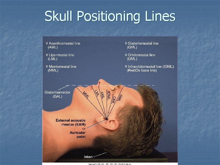 Skull Positioning Lines Skull Positioning Lines