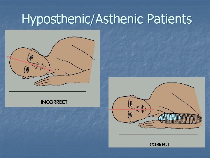 Hyposthenic/Asthenic Patients Hyposthenic/Asthenic Patients