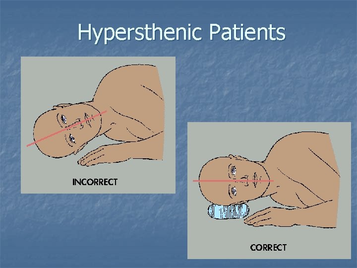 Hypersthenic Patients Hypersthenic Patients