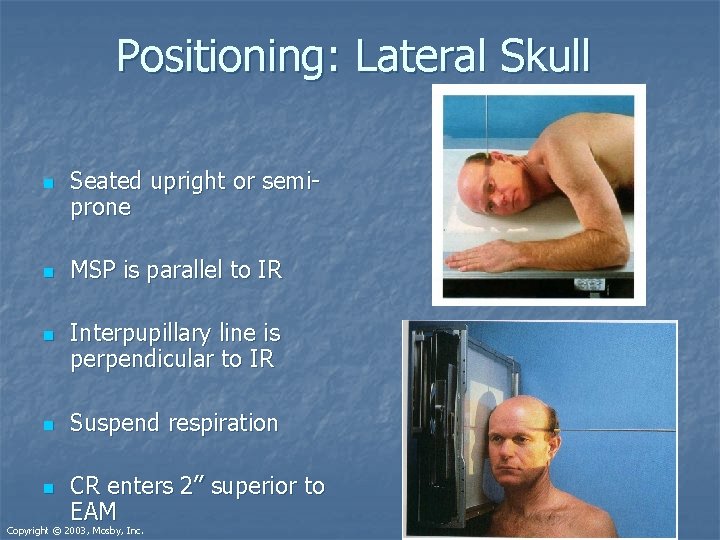 Positioning: Lateral Skull n n n Seated upright or semiprone MSP is parallel to Positioning: Lateral Skull n n n Seated upright or semiprone MSP is parallel to